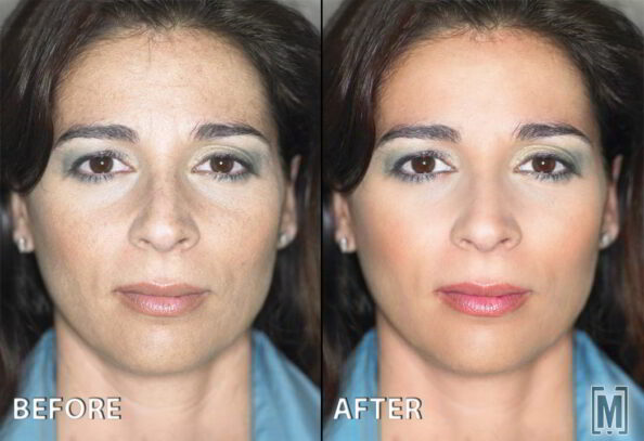 face retouch Milan Olah - graphic designer - face retouch